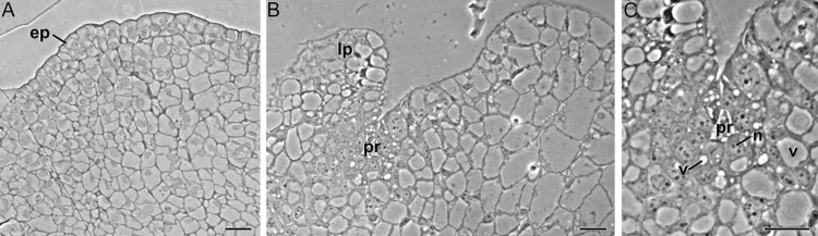 Histological study of the formation of adventitious buds from corm-derived calli in saffron.