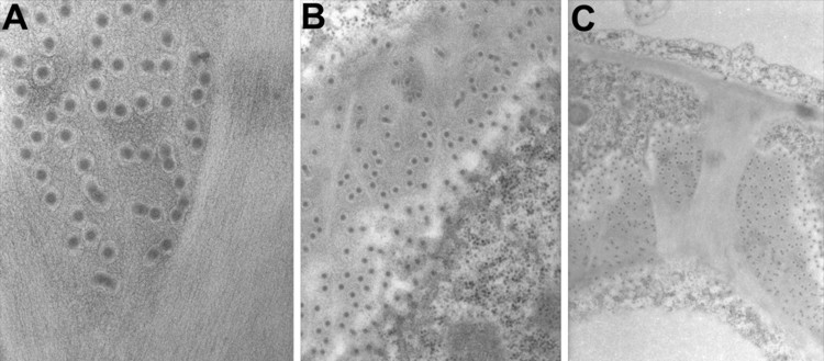Transmission electron microscopy.